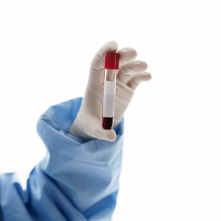 CGR déleucocyté