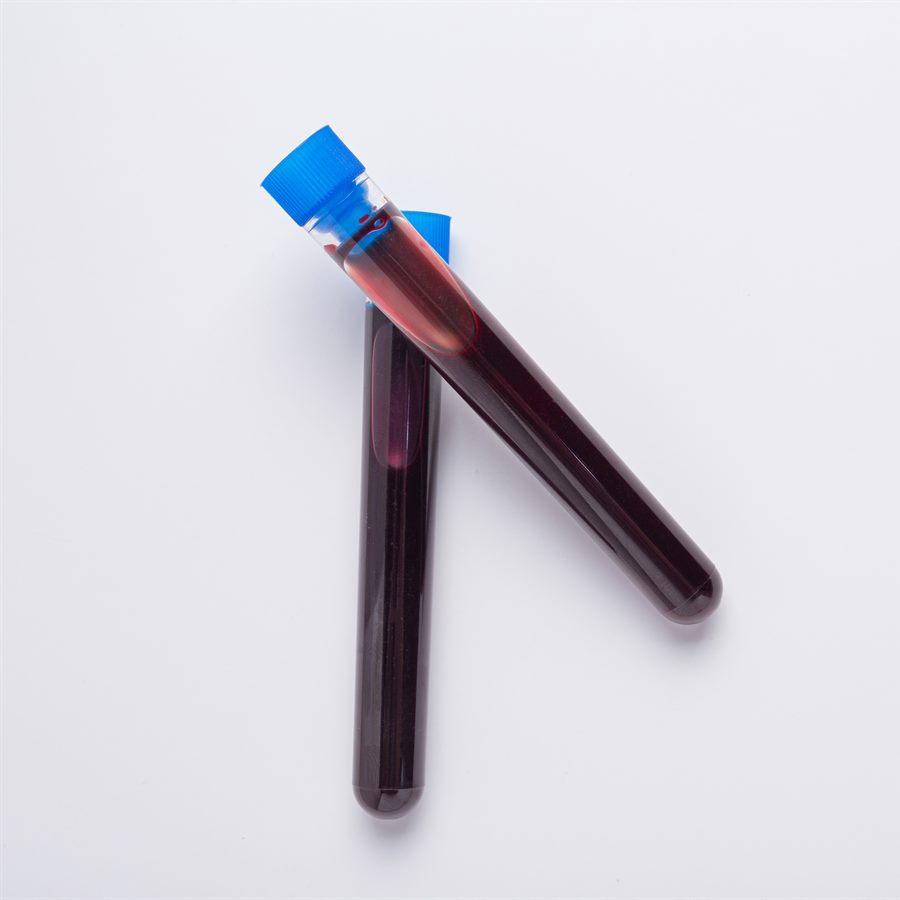 Plasma frais congelé